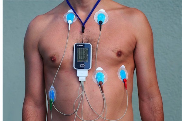 ritm-holter ritm holter