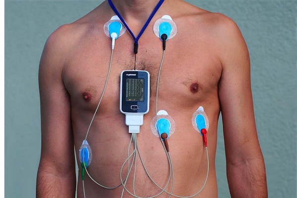 ritm-holter