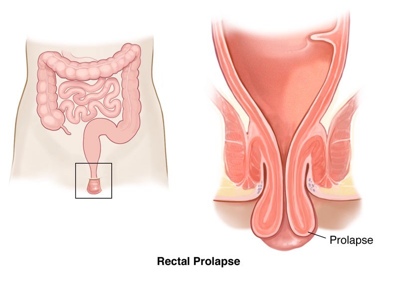 anal apse