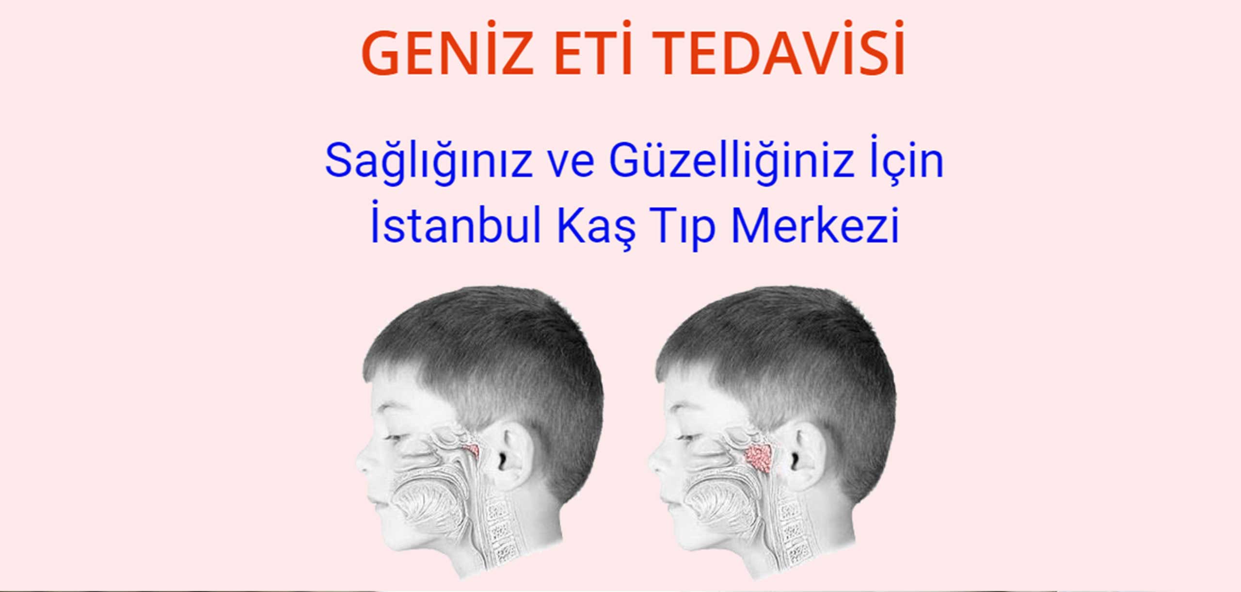 Geniz Eti Tedavisi Istanbul Ozel Kas Tip Merkezi
