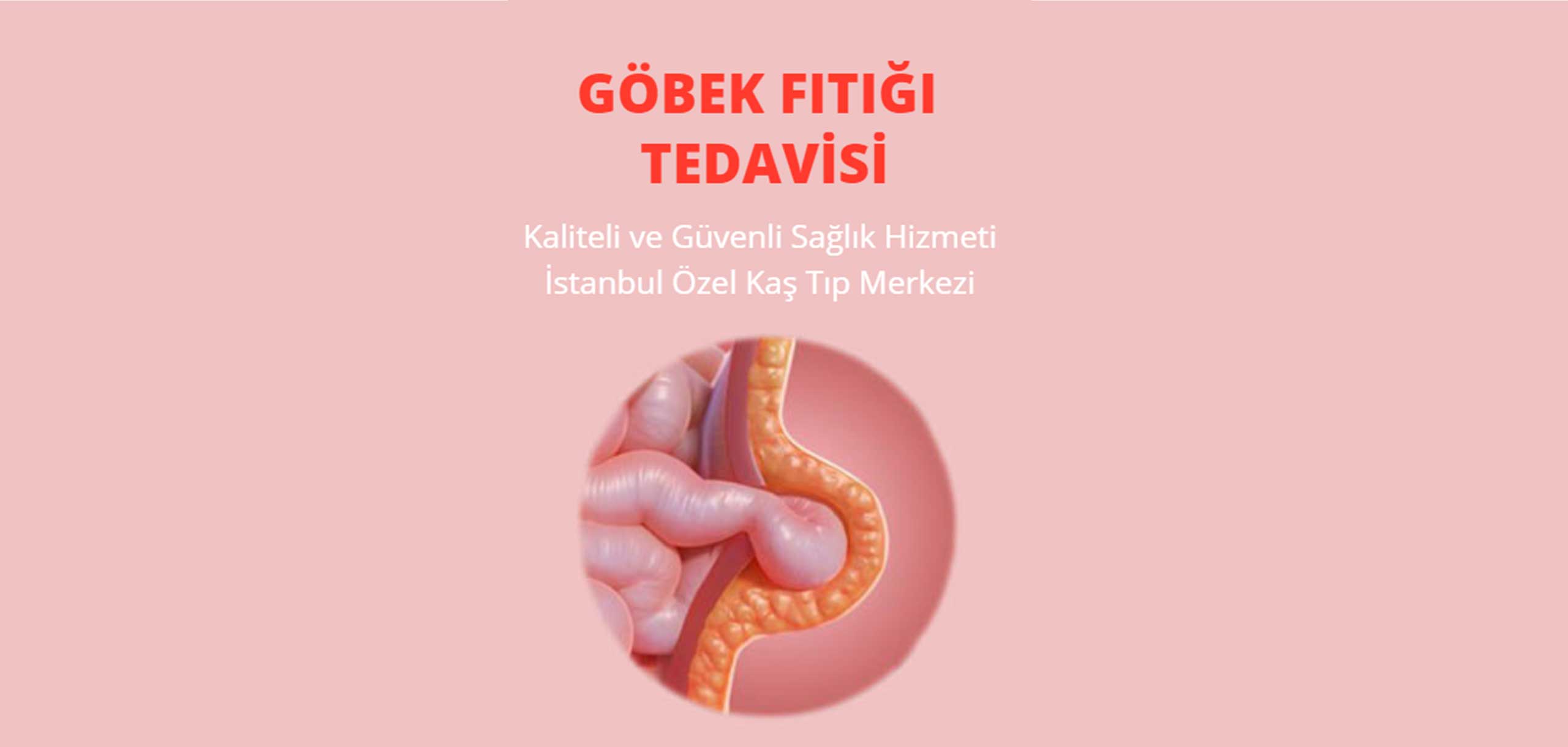 göbek fıtığı tedavisi