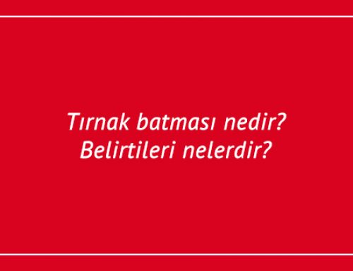 Tırnak batması nedir? Belirtileri nelerdir?