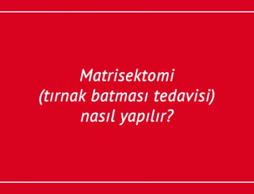 Matrisektomi (tırnak batması tedavisi) nasıl yapılır?