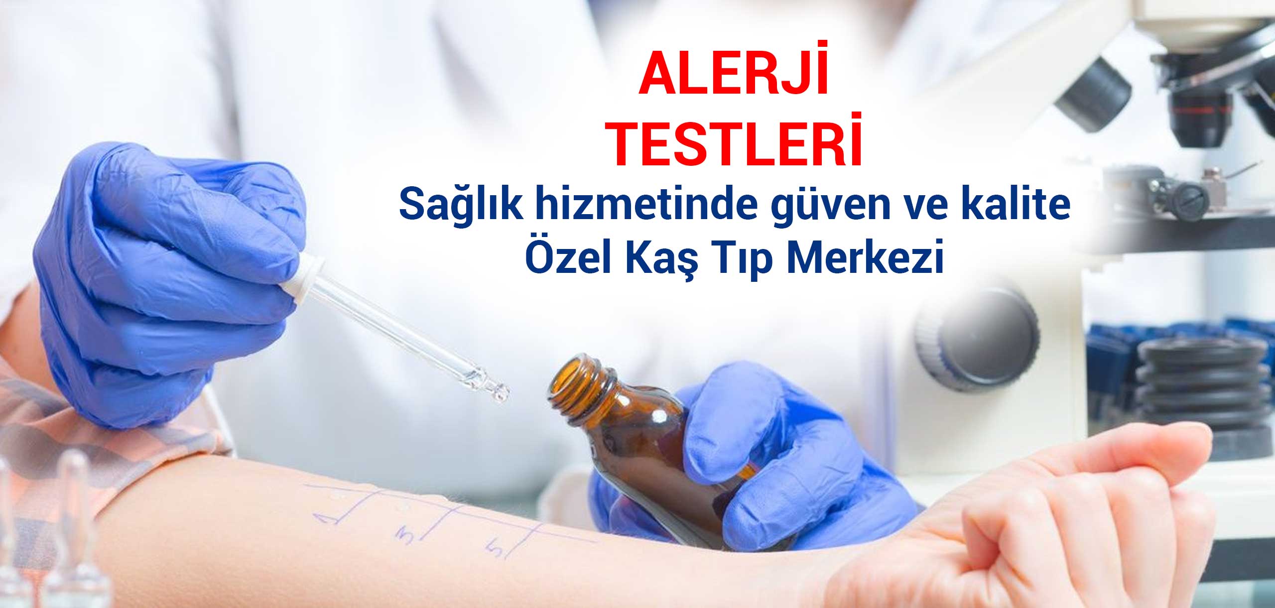 alerji testi