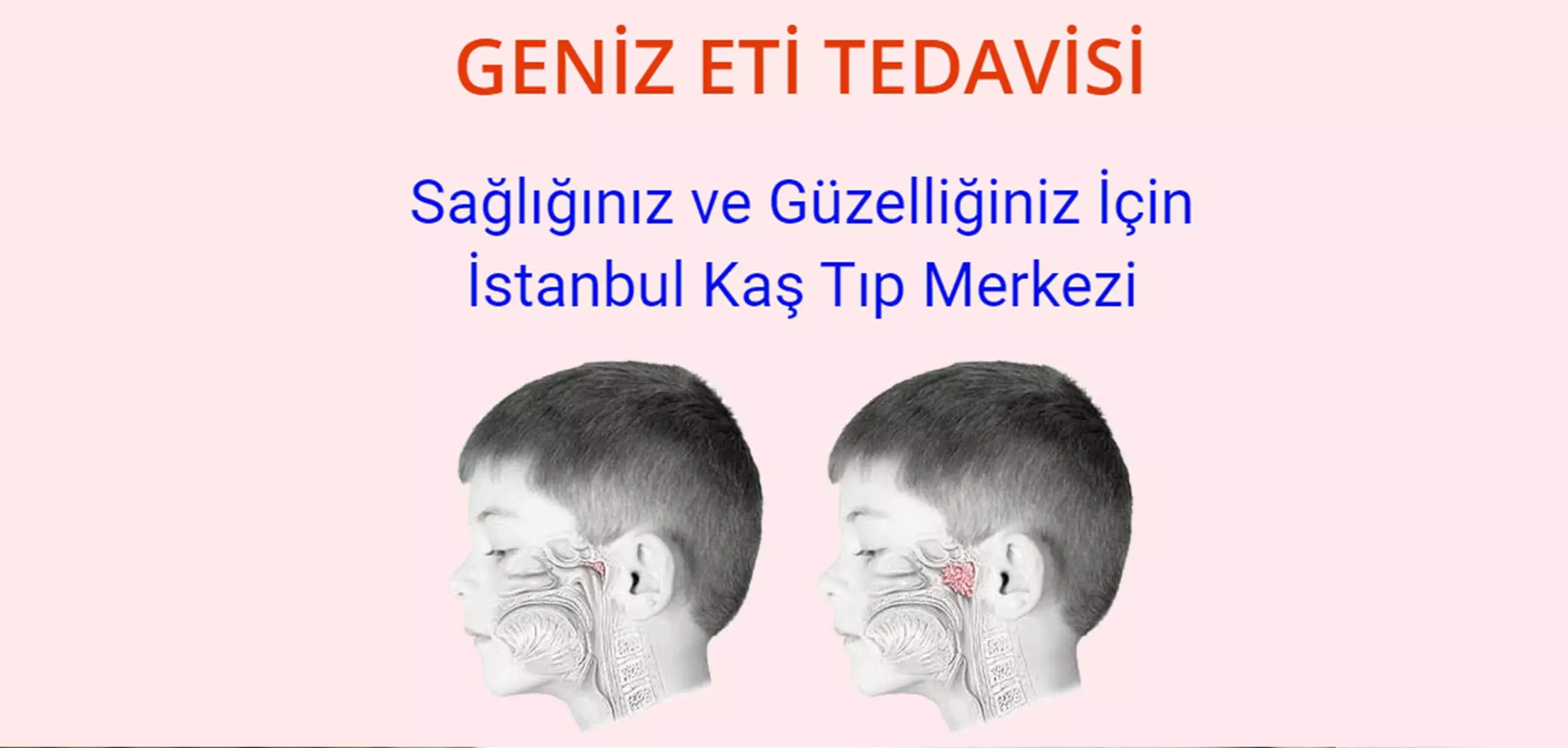 geniz eti tedavisi