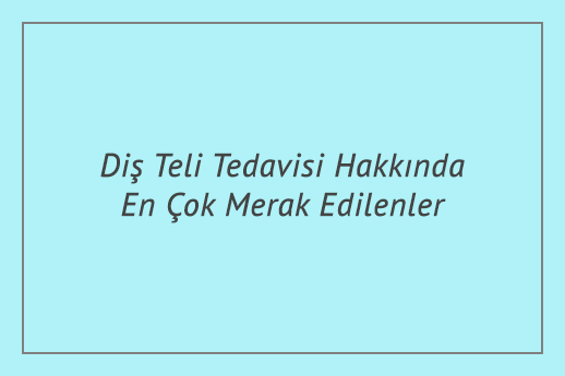 Diş Teli Tedavisi Hakkında En Çok Merak Edilenler