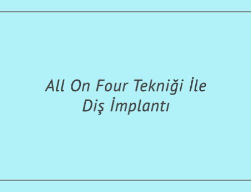 All On Four Tekniği İle Diş İmplantı