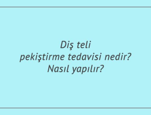 Diş teli pekiştirme tedavisi nedir? Nasıl yapılır?