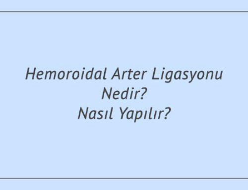 Hemoroidal Arter Ligasyonu Nedir? Nasıl Yapılır?