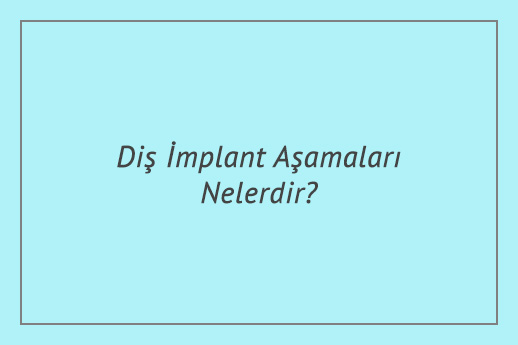 Diş İmplant Aşamaları Nelerdir?